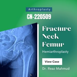 Hip Hemiarthroplasty [CN-220509]