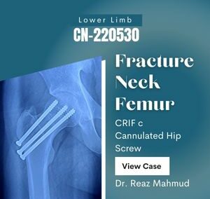 Fracture Neck of Femur | CRIF c Cannulated Hip Screw [CN-220530]
