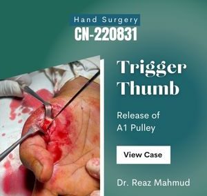 Trigger Thumb Release [CN-220831]
