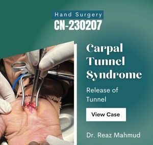 Carpal Tunnel Release [CN-230207]