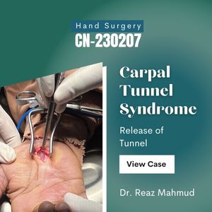 Carpal Tunnel Release [CN-230207]