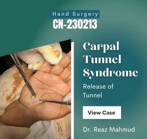 Carpal Tunnel Release [CN-230213/1]
