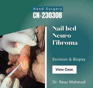 Nailbed Tumour with Ingrown Nail [CN-230308]