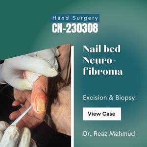 Nailbed Tumour with Ingrown Nail [CN-230308]