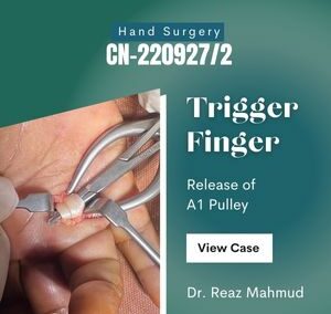 Trigger Finger Release [CN-220927/2]
