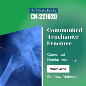 Hip Hemiarthroplasty on Trochanteric Fracture [CN-221020]