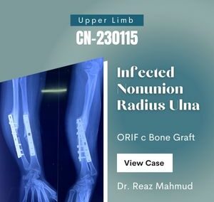 Infected Non-union of Radius-Ulna | Revision Surgery [CN-230115]