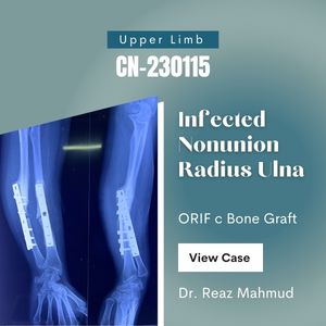 Infected Non-union of Radius-Ulna | Revision Surgery [CN-230115]