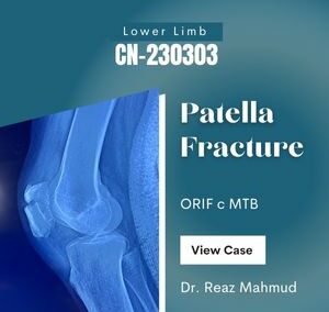 Fracture Patella | ORIF c MTB [CN-230303]
