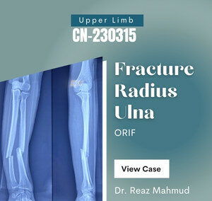 Fracture Shaft of Radius-Ulna [CN-230315]