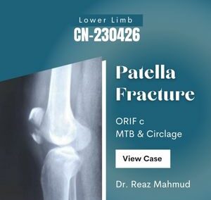 Patella Fracture | ORIF c MTB & Cerclage [CN-230426]