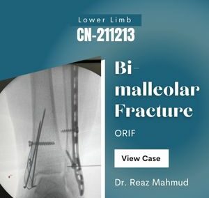 Bimalleolar Ankle Fracture | ORIF [CN-211213]