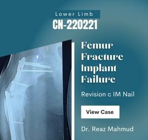 Femur Fracture Revision Surgery [CN-220221]