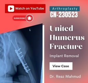 United Humerus Fracture | Implant Removal [CN-230523]