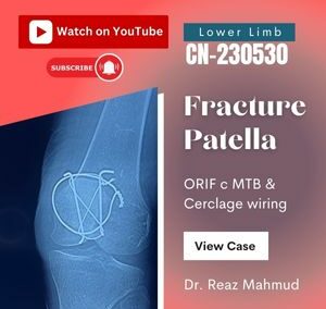 Fractured Patella | ORIF [CN-230530]