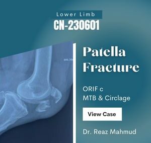 Fracture Patella | ORIF [CN-230601]