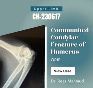 Communited Condylar Fracture of Humerus [CN-230617]