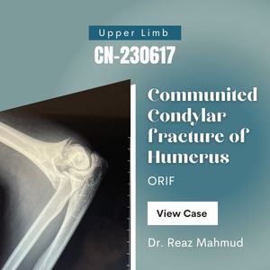 Communited Condylar Fracture of Humerus [CN-230617]