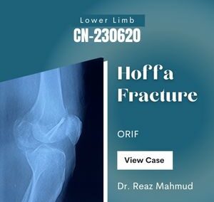 Hoffa Fracture of Lateral Femoral Condyle [CN-230620]