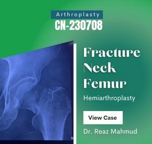 Hip Hemiarthroplasty [CN-230708]