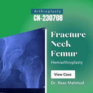 Hip Hemiarthroplasty [CN-230708]