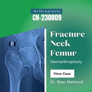 Fracture Neck of Femur [CN-230809]