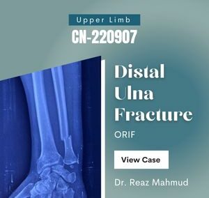 Distal Ulna fracture | ORIF [CN-220907]