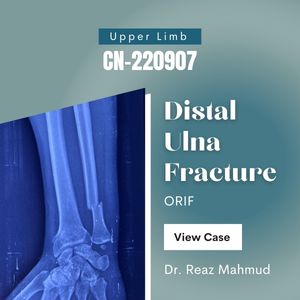 Distal Ulna fracture | ORIF [CN-220907]