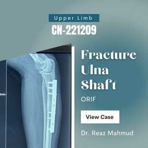 Ulna shaft fracture | ORIF [CN-221209]