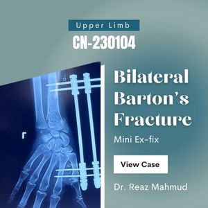 Bilateral Barton’s fracture | Mini Ex-fix [CN-230104]