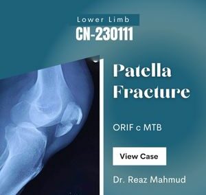 Patella Fracture | ORIF [CN-230111]