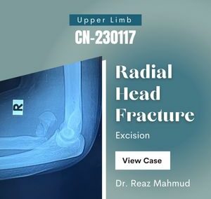 Radial head fracture | Excision [CN-230117]