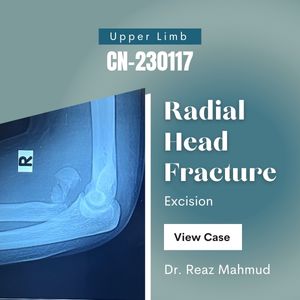 Radial head fracture | Excision [CN-230117]