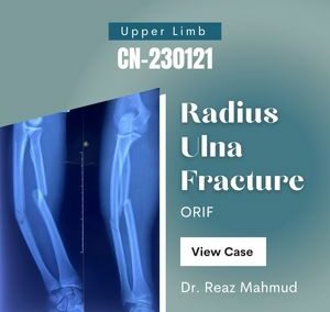 Fracture Radius Ulna | ORIF [CN-230121]