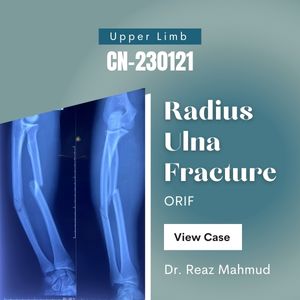 Fracture Radius Ulna | ORIF [CN-230121]