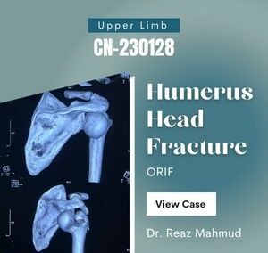 Fracture dislocation of humerus head | PHILOS [CN-230128]