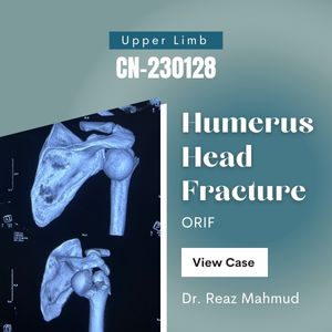 Fracture dislocation of humerus head | PHILOS [CN-230128]