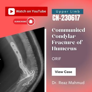 Communited Condylar Fracture of Humerus [CN-230617]