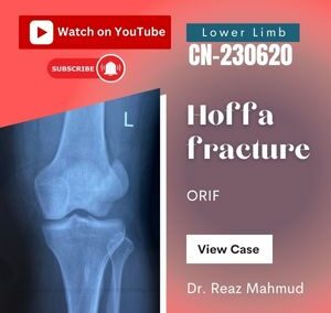 Hoffa fracture of Femoral condyle [CN-230620]