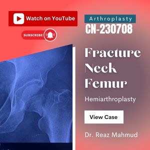 Fracture neck femur | Hemiarthroplasty [CN-230708]