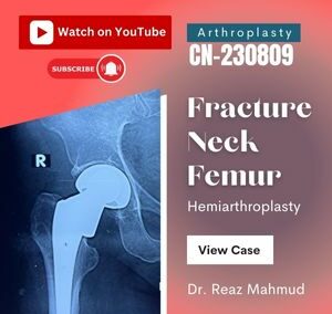 Fracture neck femur | Hemiarthroplasty [CN-230809]