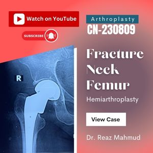 Fracture neck femur | Hemiarthroplasty [CN-230809]