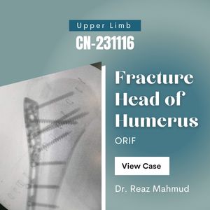 Humeral head fracture | PHILOS [CN-231116]