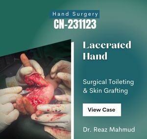 Lacerated Hand [CN-231123]