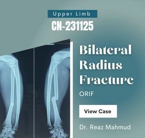 Bilateral radius fracture | ORIF [CN-231125]