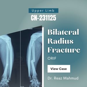 Bilateral radius fracture | ORIF [CN-231125]