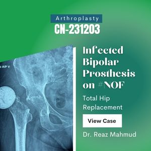 Total Hip Replacement [CN-231203]