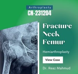Hip Hemiarthroplasy on 9 months old Fracture Neck Femur [CN-231204]