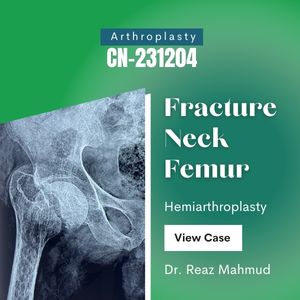 Hip Hemiarthroplasy on 9 months old Fracture Neck Femur [CN-231204]