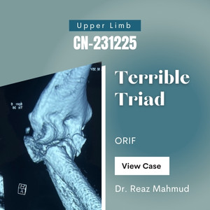 Terrible Triad | Radial Head Excision & Cornoid Process Fixation [CN-231225]